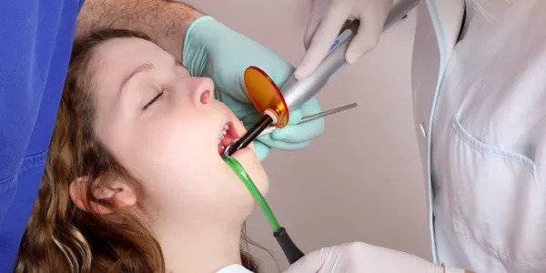 Dentist and assistant using dental UV curing light