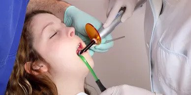 Dentist and assistant using dental UV curing light